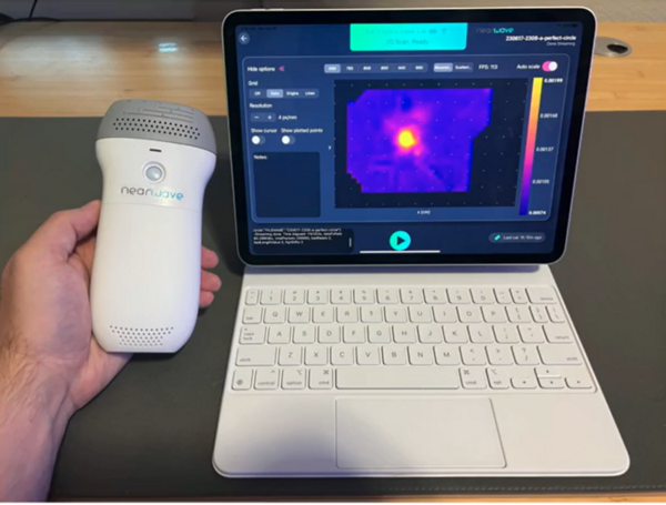 NearWave handheld scanner and iPad shown displaying a 2D image of a scan taken using the device