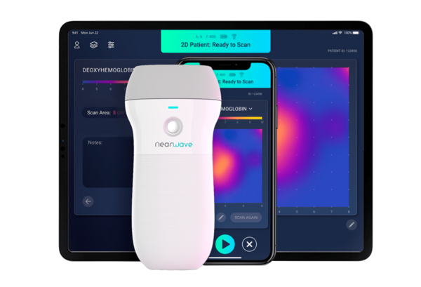 NearWave handheld scanner, iPhone, and iPad showing 2D heat maps