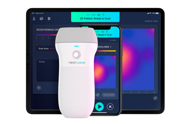 NearWave handheld scanner, iPhone, and iPad showing 2D heat maps