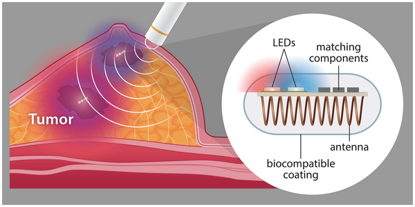 Wireless implantable device for visual guidance during lumpectomy